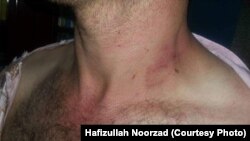 ارشیف: یو خبریال چې د طالبانو له لوري وهل او ډبول شوی دی.