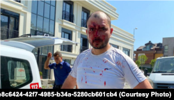 Aktivista koji je pretučen dok je pokušavao predati pismo predsjedniku Serdaru Berdimuhamedovu u turkmenistanskom konzulatu u Istanbulu u avgustu prošle godine.