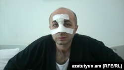 Հայկ Խանումյանը Ստեփանակերտի հիվանդանոցում: 7-ը հունիսի, 2016 թ․