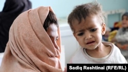 ارشیف: په افغانستان کې یو خوارځواکی ماشوم چې په یوه روغتون کې تر درملنې لاندې دی.
