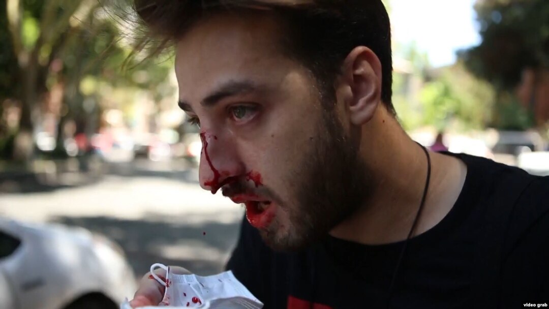 Una dintre victimele atacului protestatarilor anti-LGBT.