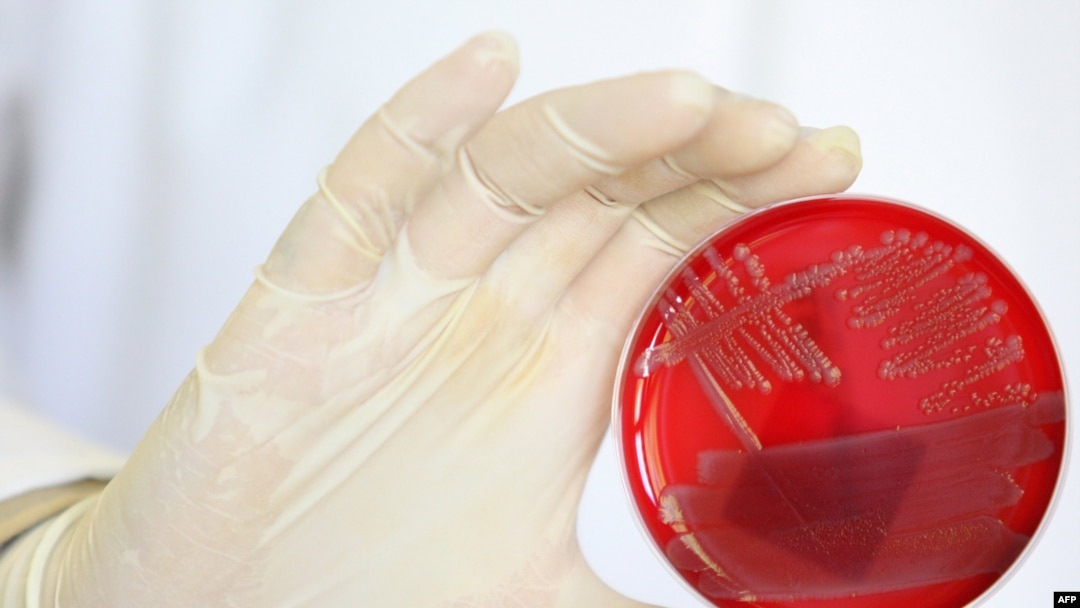 Бактерія Е.coli