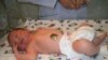 Armenia -- World's 7 billionth baby Vahram Voskanian born in Artik, Armenia, 31Oct2011