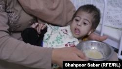 يو خوارځواک ماشوم، انځور - ارشيف