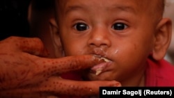A malnourished child is fed at UNICEF medical center in Bangladesh.